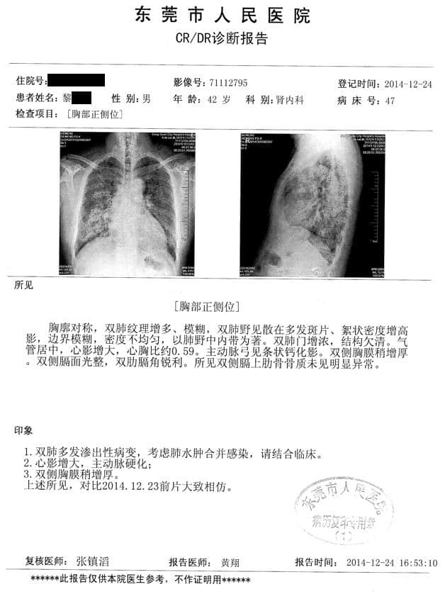 尿毒症、肺水肿合并感染，他却选择了相信中医