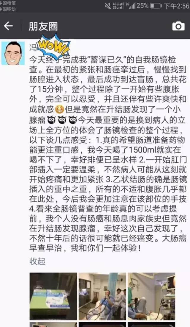 医生给自己做肠镜，只为减轻病人的痛苦