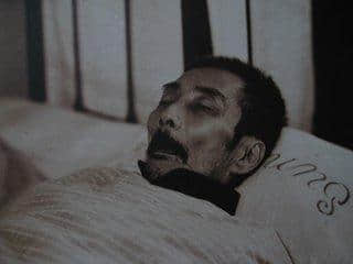 鲁迅先生从患病到离世，为其诊治的日本医生有多少待解之谜